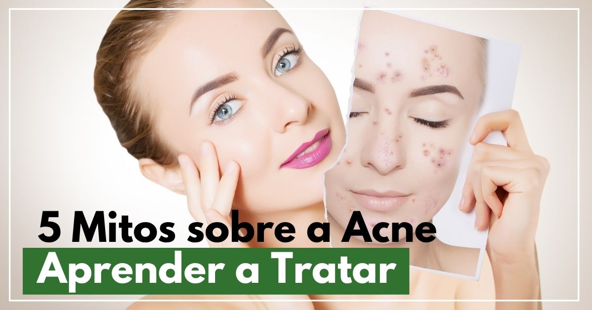 5 mitos sobre a acne desvendando para aprender a tratar