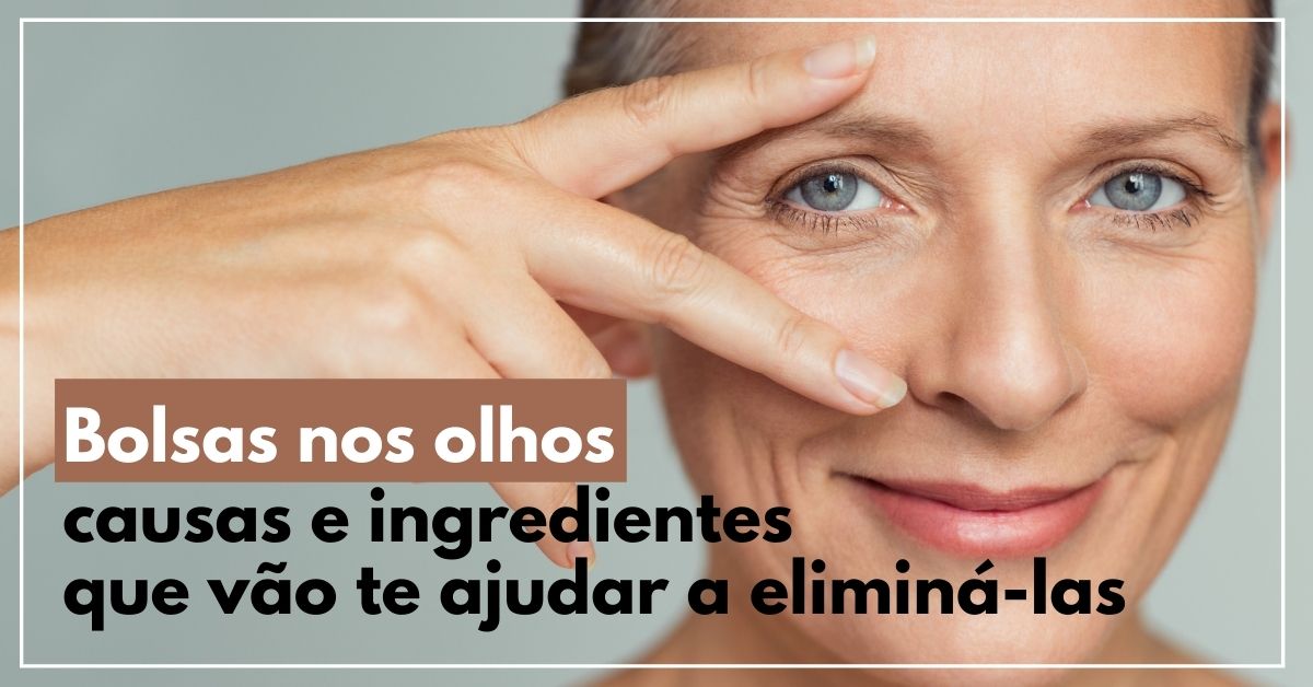 Bolsas nos olhos: causas e ingredientes que vão te ajudar a eliminá-las