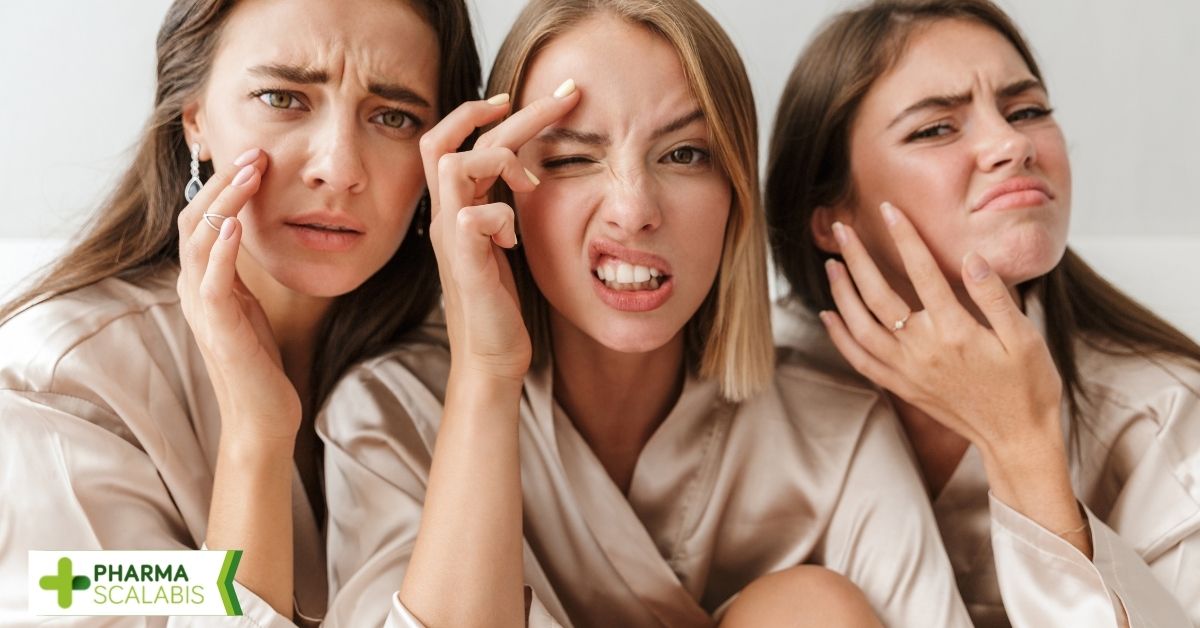 Como tirar borbulhas internas? Saiba o que fazer para se livrar da inflamação no rosto